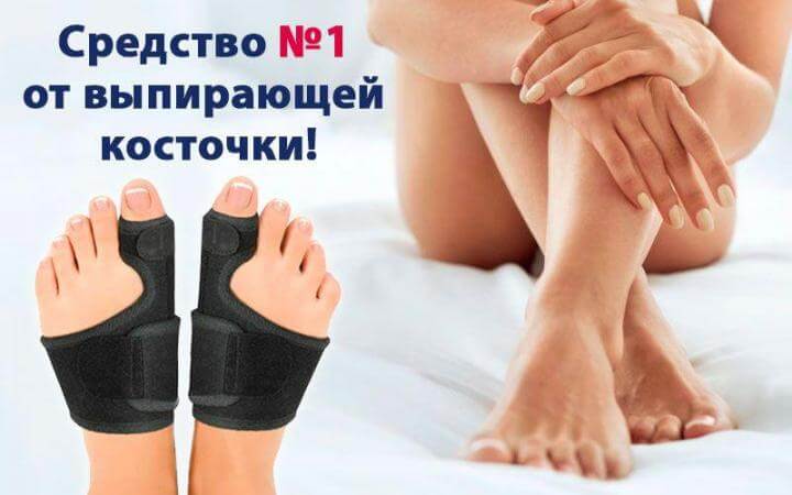 Лечение магнитной вальгусной шиной MagnetFix 